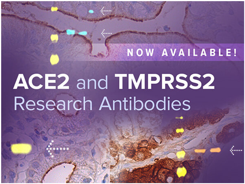 ACE2_and_TMPRSS2_Research_Antibodies_Available_2.PNG