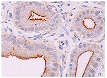 ACE2_and_TMPRSS2_Research_Antibodies_Available_3.PNG