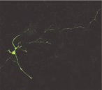 初代海馬神経細胞へのトランスフェクション