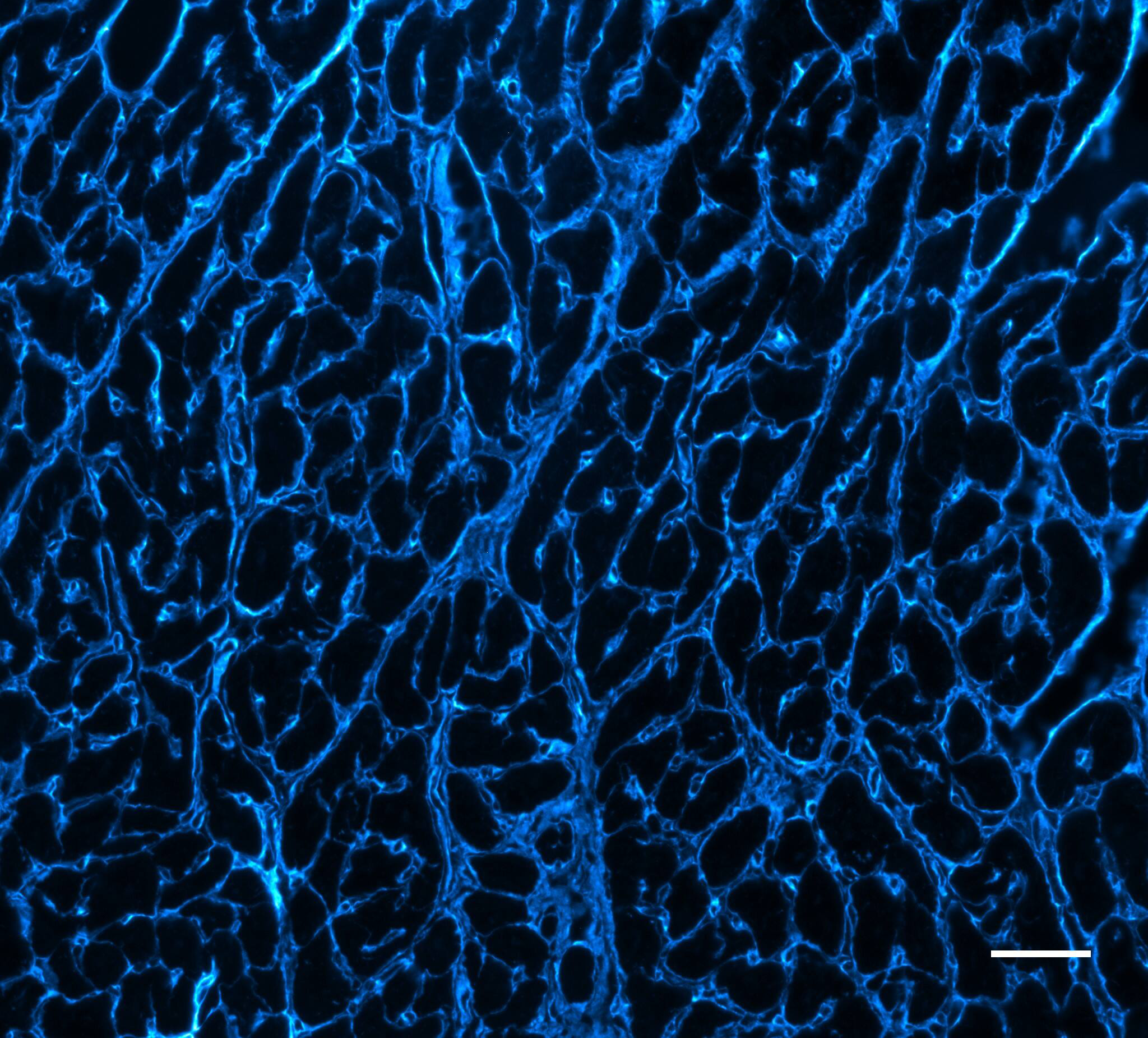 ブタ筋細胞間の間質空間に存在するコラーゲンⅥを JF549 で観察した画像