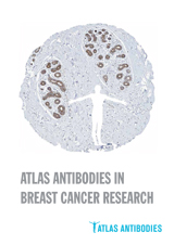 atlas-antibodies-in-breast-cancer-research.jpg