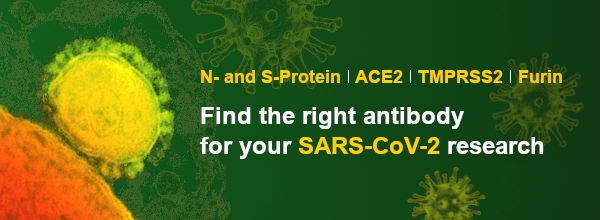 Find_the_right_antibody_for_your_SARS-CoV-2_research_header.png