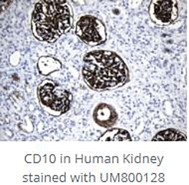 CD10_stained_with_UM800128.jpg