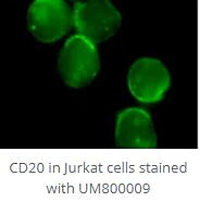CD20_stained.jpeg