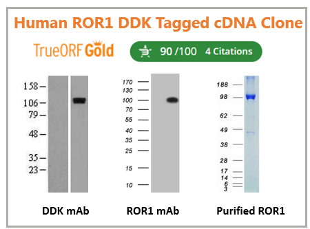 Human_ROR1_DDK_Tagged_cDNA_Clone.png