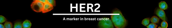 HER2_in_breast_cancer_2.png