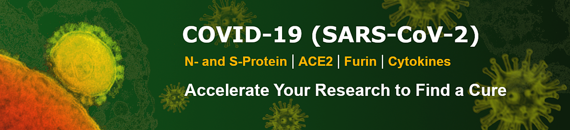 SARS-CoV-2_Why_is_this_coronavirus_potent_2.png