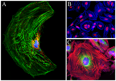 Using_Phalloidin's_Smaller_Size_for_Improved_Actin_Labeling_Density_and_Imaging_2.png