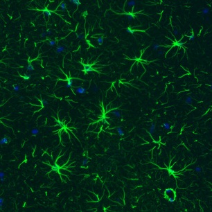 astrocytes.jpg