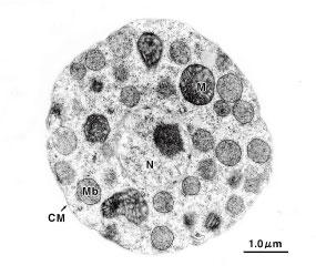 Electron microscopical photo of yeast cell