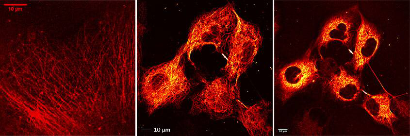 Taxol Janelia Fluor 646で標識したCOS7細胞の画像