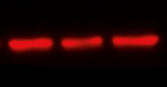 Detection of a-Tubulin with Fluorescence