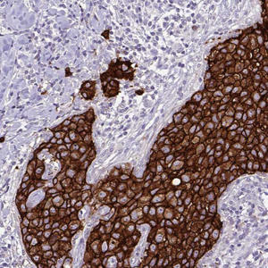 amab90627-ihc-1.jpg
