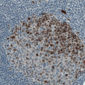 amab90870-ihc-1.jpg