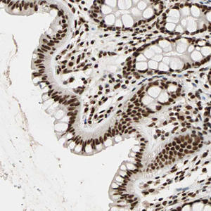 hpa007484-ihc-1.jpg