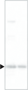 id22_GAPDH1.png