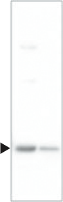 id22_GAPDH2.png
