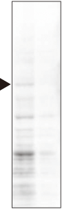 id22_Nup98-tTBS.png
