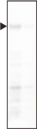 id22_seinouhikaku_tTBS.png